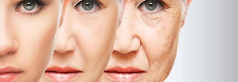 My Botox LA
