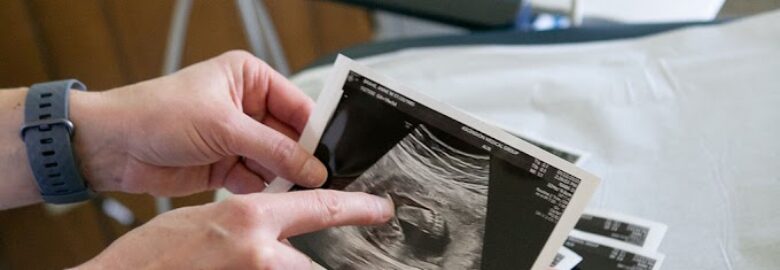 Forward Fertility